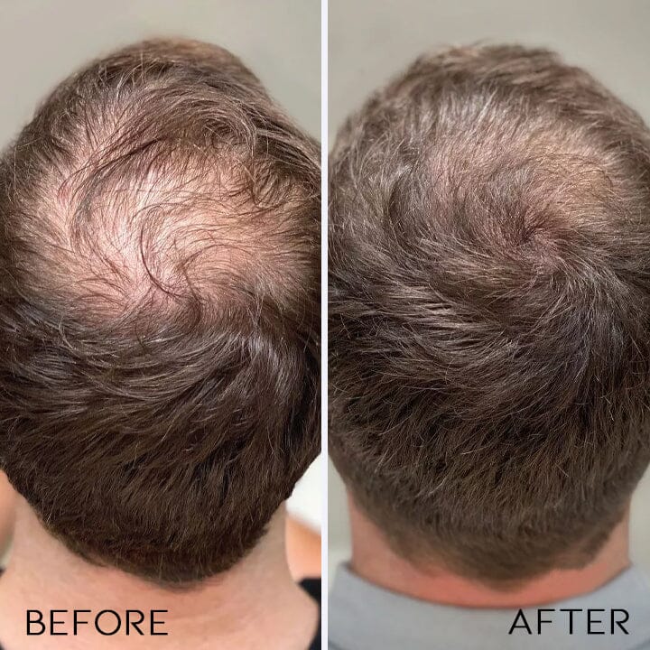 Black & Thick Hair Fallopia Multiflora Shampoo Bar Every Day And Night